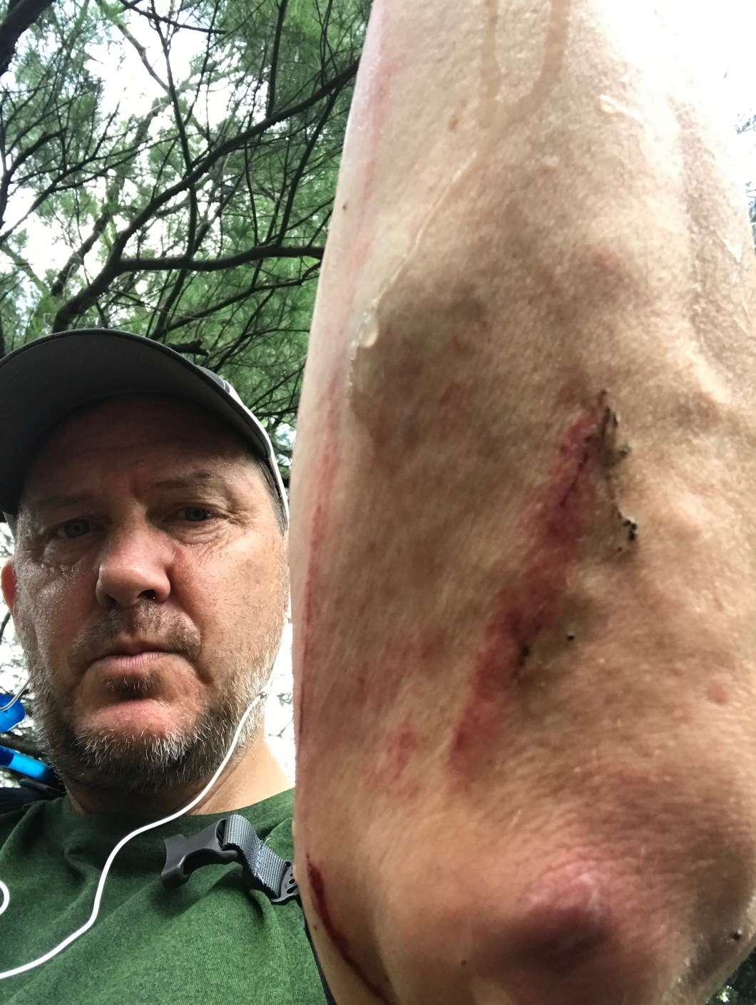 A79235F1-3791-4CAA-8118-025C52FB6721